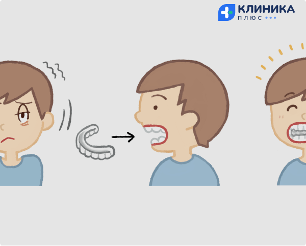 Капа для больных с синдромом туретта 